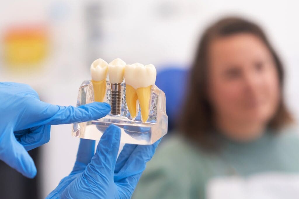 dentist in blue gloves showing a female patient a dental implant model